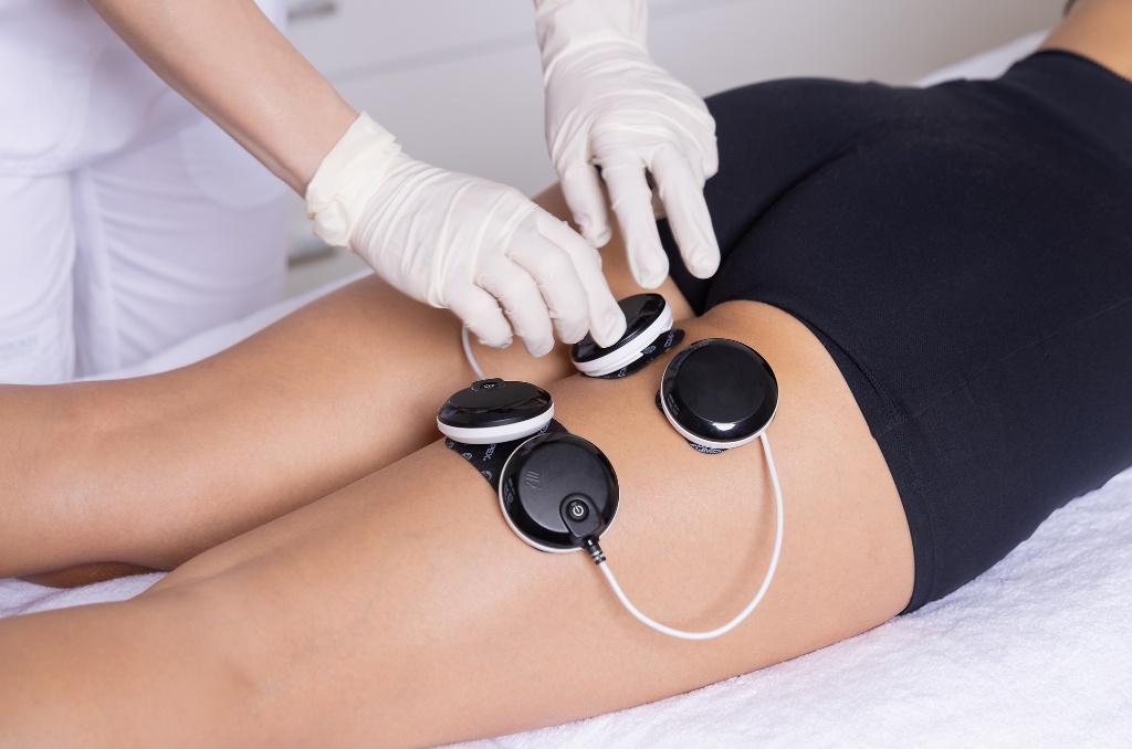 elektromišićna stimulacija