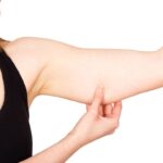 zatezanje koze nadlaktica